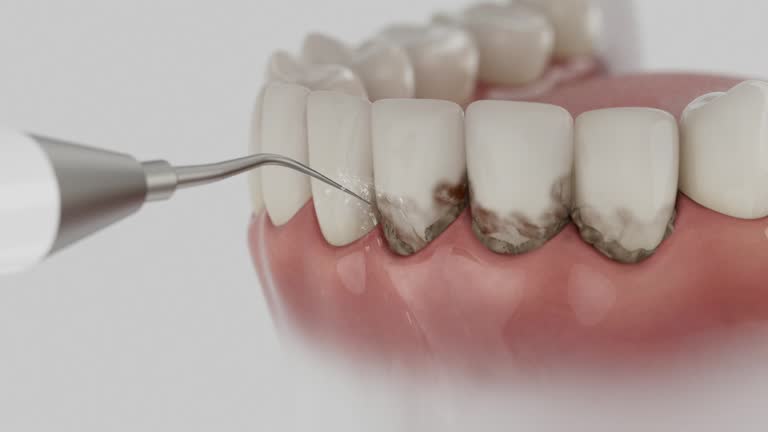 Reliable Tooth Extraction contractor in Leona Valley, CA by Smile Center Dentistry